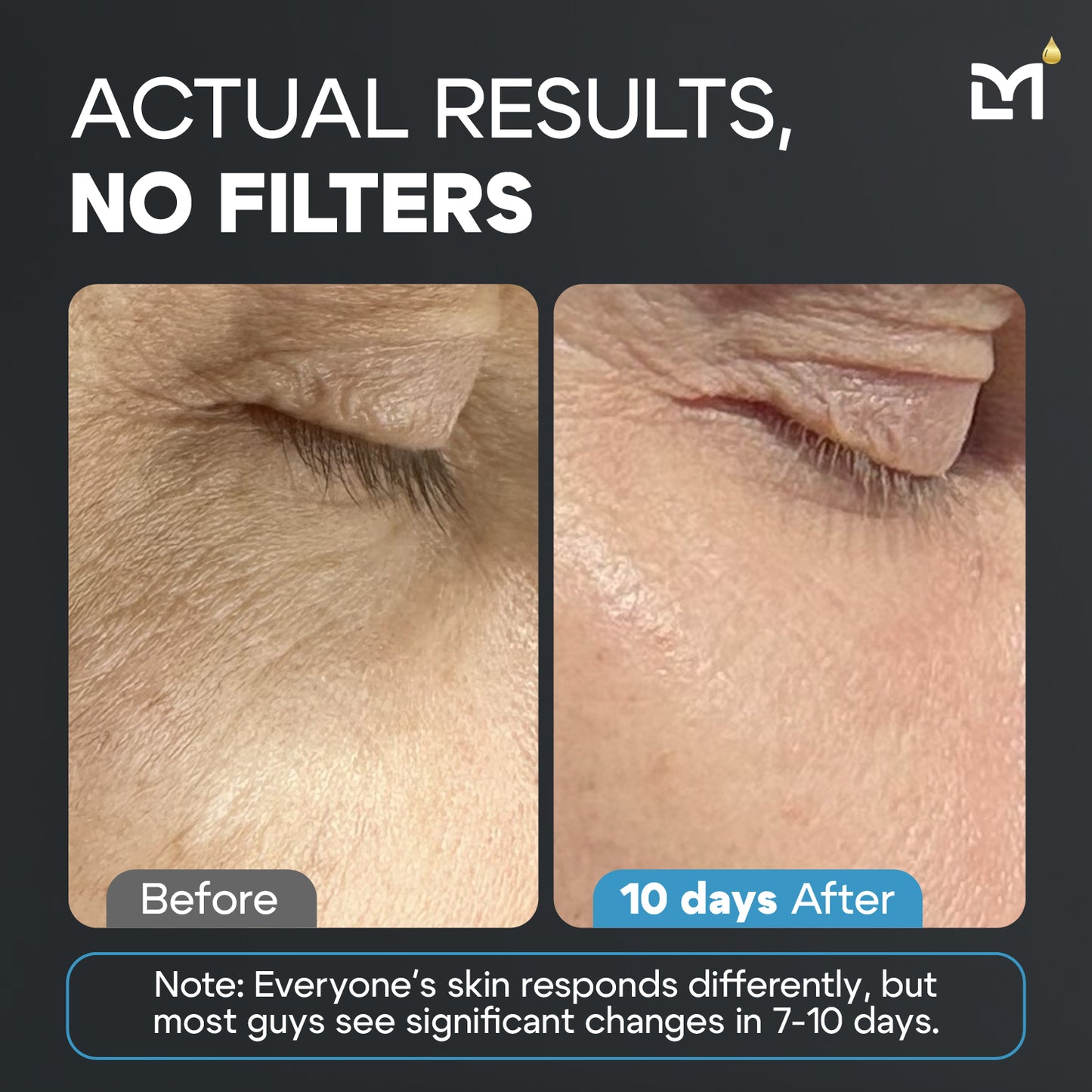 Titan Skincare Kit
