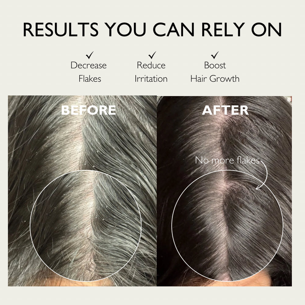 Pure Scalp Mask