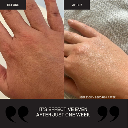 Activating Hand Serum