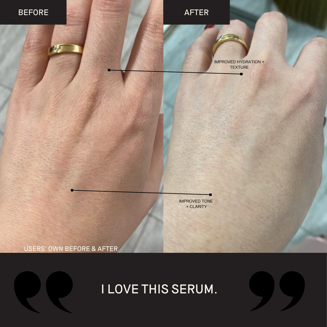 Activating Hand Serum