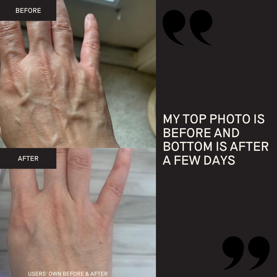 Activating Hand Serum