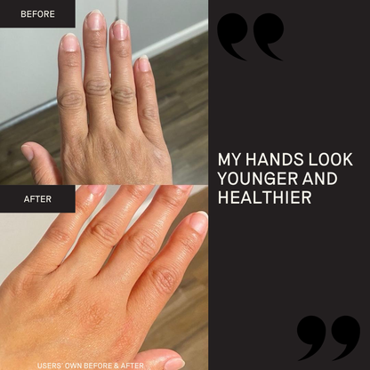 Activating Hand Serum