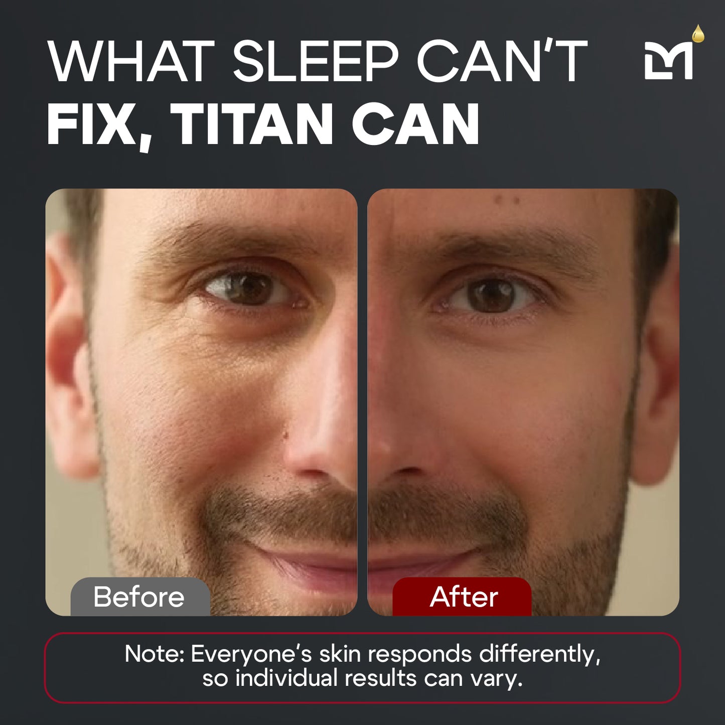 Titan Peptide Eye Gel