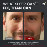 Titan Peptide Eye Gel