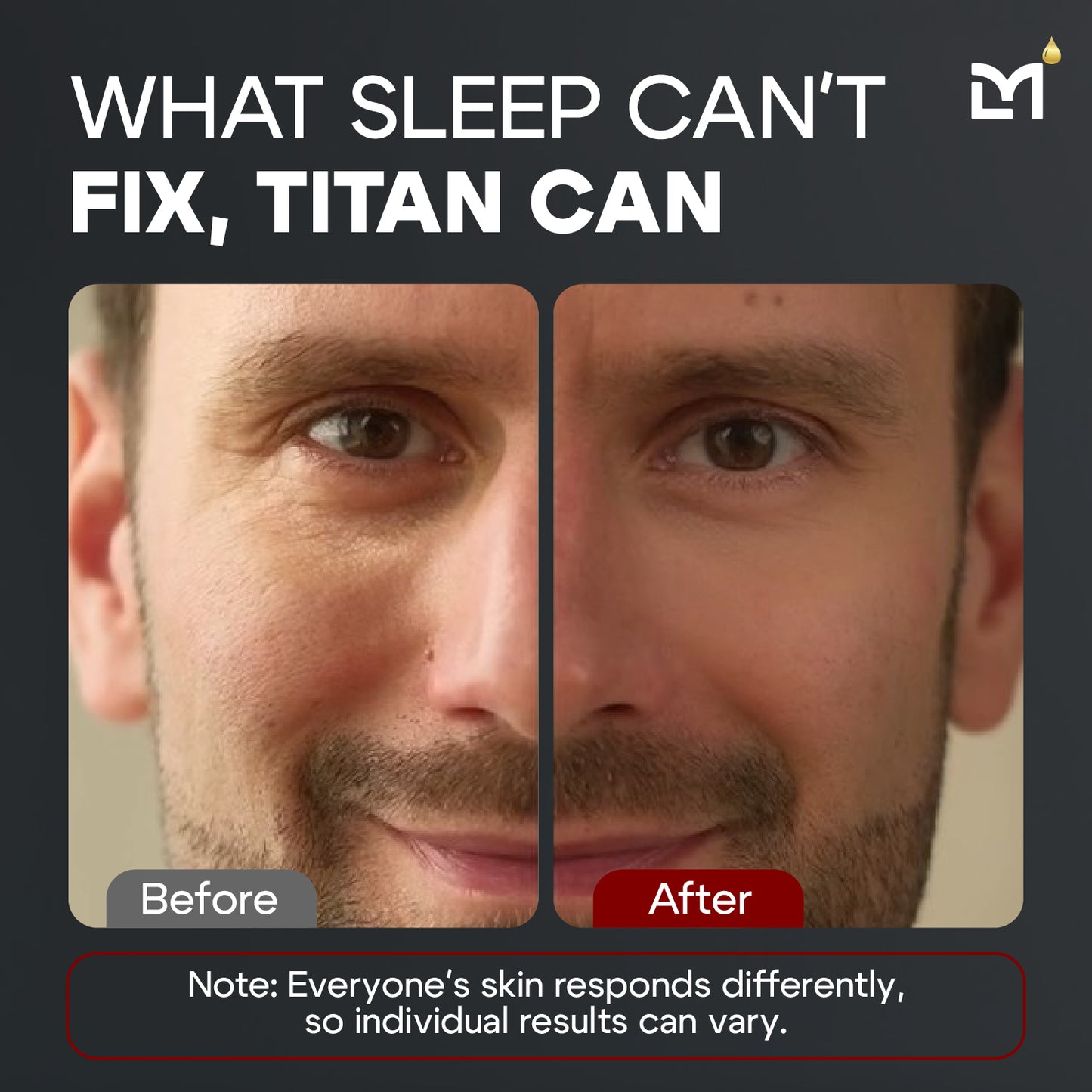 Titan Eye Cream