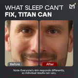 Titan Eye Cream
