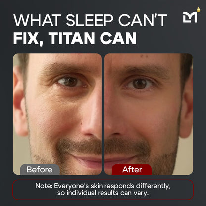 Titan Eye Cream