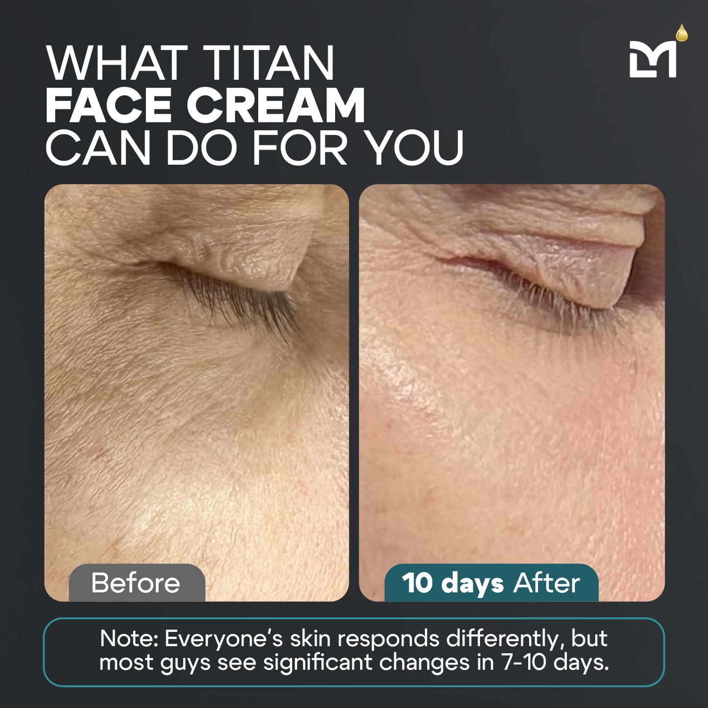 Titan Cream