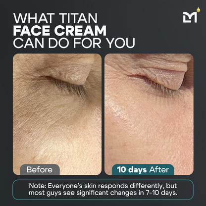 Titan Cream