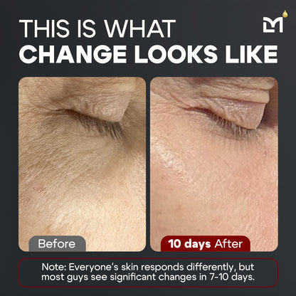 Titan Peptide MAX Serum