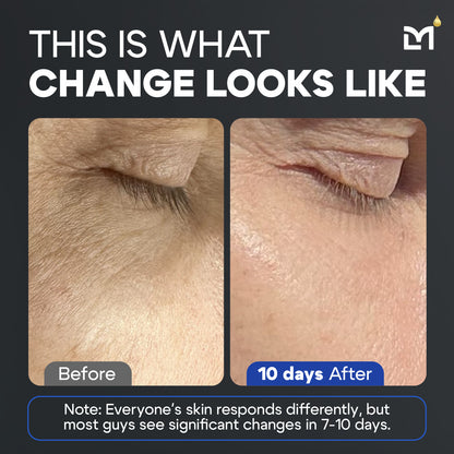 Titan Peptide Serum