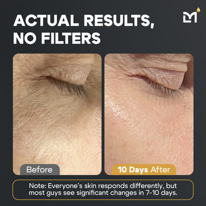 Titan 2025 Golden Skincare Kit