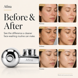 Afina Faucet Filter for Skincare