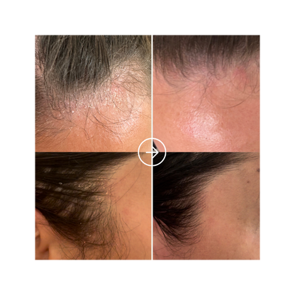 Pure Scalp Relief