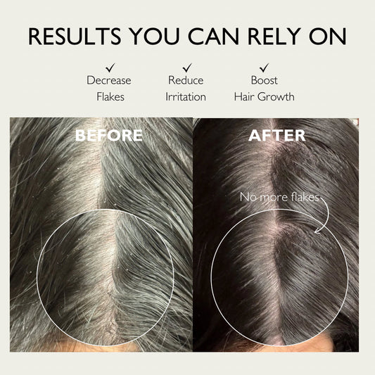 Pure Scalp Mask