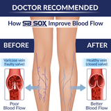 Compression Socks (20-30mmHg)